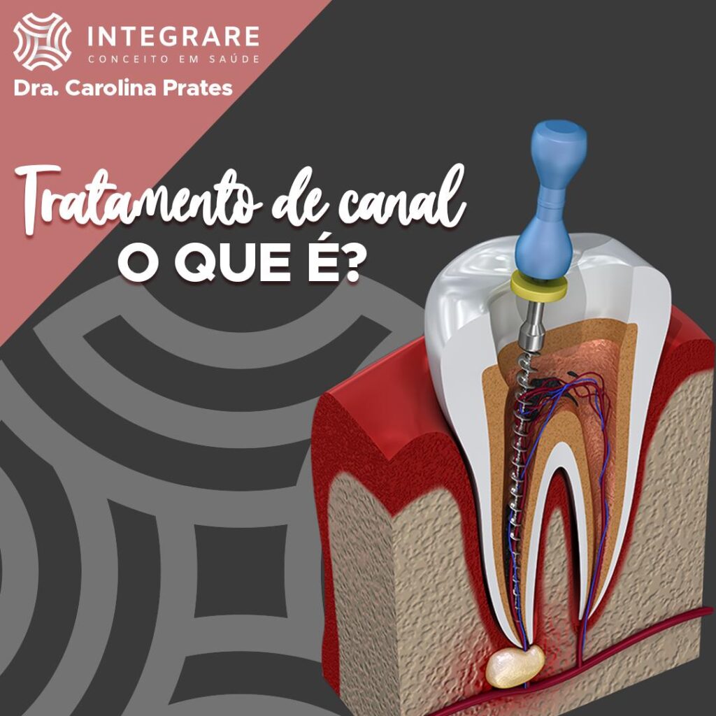 Endodontia é Muito Além Do Tratamento De Canal Veja O Que Mais A Especialidade Oferece Integrare 1247